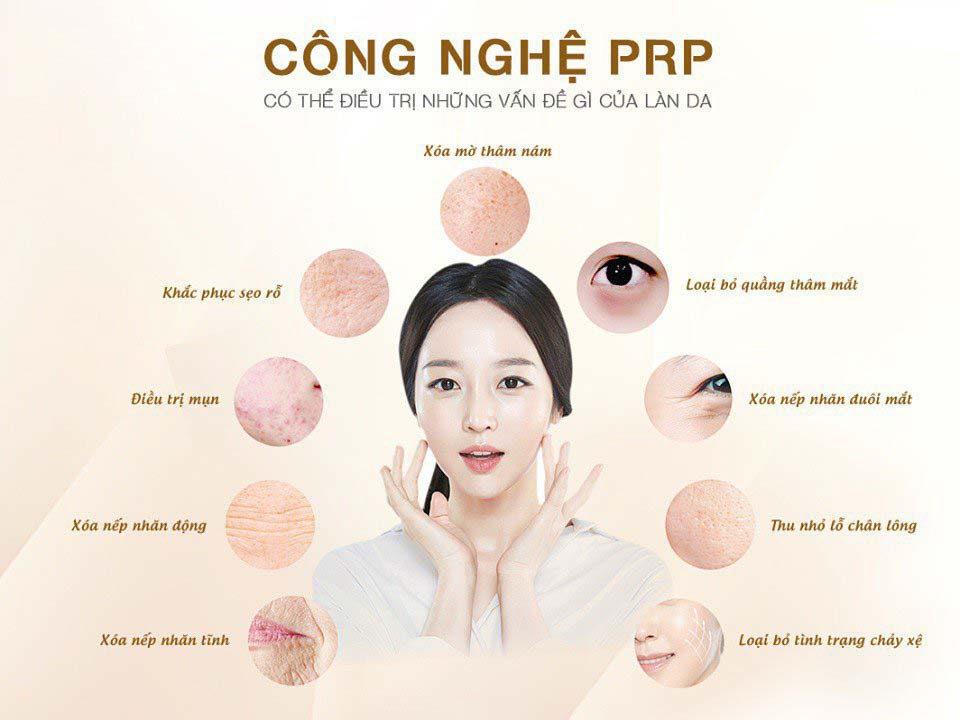 phương pháp prp tại skin retreat