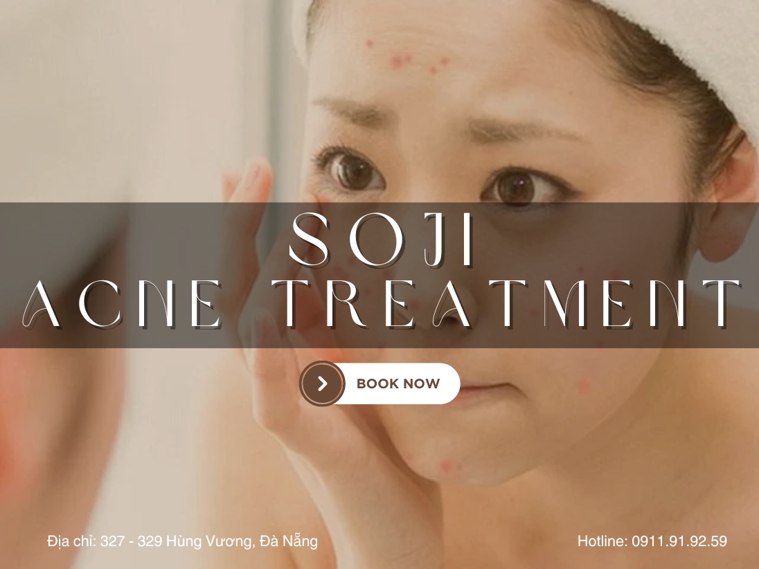 Soji – làm sạch mụn không xâm lấn